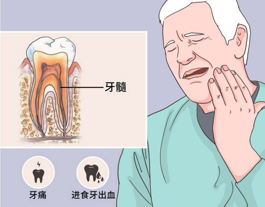 老人得牙髓炎有什么好的治疗方法？