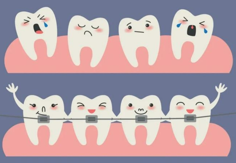 青少年牙齿矫正几岁效果好？