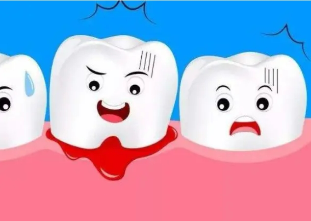 牙龈炎治疗后，效果能维持多久？