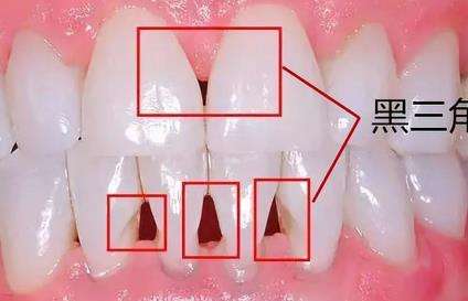 口臭会带来负面的伤害吗？