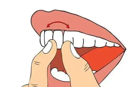 长期用牙签剔牙危害有多大？