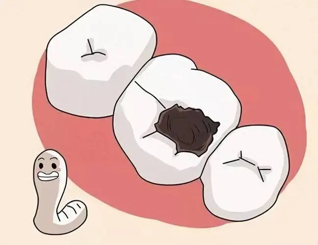 什么是牙齿黑三角?诱发黑三角的原因有哪些？