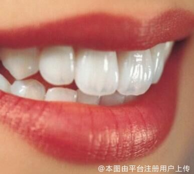 牙周炎是什么原因引起的？