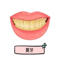 牙齿发黄怎么去除？日常有哪些注意事项