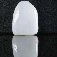 冷光美白和瓷贴面哪个好？区别在哪里？
