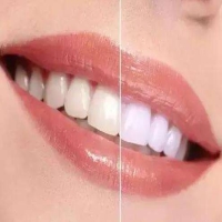 牙齿天生黄的原因有哪些？