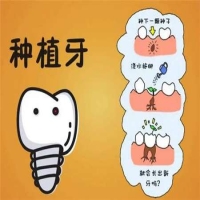 种植牙与传统缺牙修复方法有什么区别？