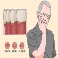拔智齿前需要做哪些准备？