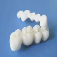 什么是全瓷烤瓷牙？全瓷烤瓷牙有什么优势？
