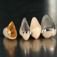什么是贵金属烤瓷牙？贵金属烤瓷牙的优点有哪些？