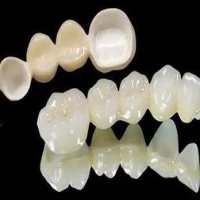 软陶瓷牙齿贴面怎么样？好不好？