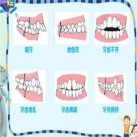 成人矫正牙齿的合适年龄是多少？矫正方案有哪些？