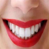 全瓷贴面和树脂贴面的区别是什么？应该怎么选择？