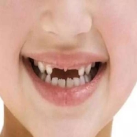 孩子换牙齿的顺序和年龄？