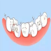 牙冠：保护牙齿的重要装置