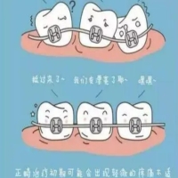 矫正牙齿期间,如果出现口腔溃疡,怎么办？