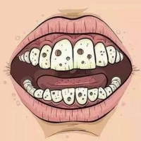 牙菌斑早期黑色怎么回事？有什么解决办法吗？