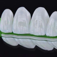 瓷贴面的价格大概是多少？受哪些因素影响？