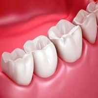 严重的四环素牙用什么可以美白？