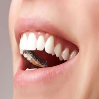 如何减轻矫正牙齿过程中的不适感？