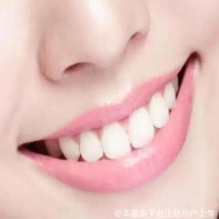 做烤瓷牙后要注意事项有哪些？