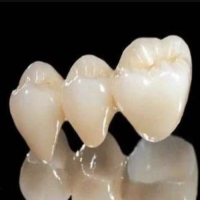 嵌体和补牙怎么选？哪个好？