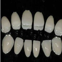 蓝瓷牙贴面好不好？与其他贴面有什么不同呢?