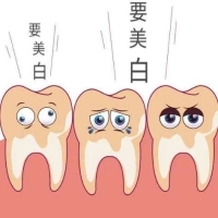 瓷贴面和全瓷牙冠哪个更好一点？两者有什么区别？